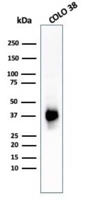 Western Blot: PMEL17/SILV Antibody (PMEL/783) [NBP2-44522]