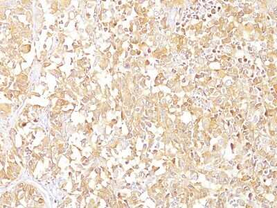 Immunohistochemistry-Paraffin: PMEL17/SILV Antibody (SPM142) - Azide and BSA Free [NBP2-34739]