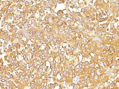 Immunohistochemistry-Paraffin: PMEL17/SILV Antibody (SPM142) - Azide and BSA Free [NBP2-34739]