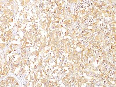 Immunohistochemistry-Paraffin: PMEL17/SILV Antibody (SPM142) [NBP2-32854]