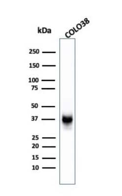 Western Blot: PMEL17/SILV Antibody (SPM142) [NBP2-32854]