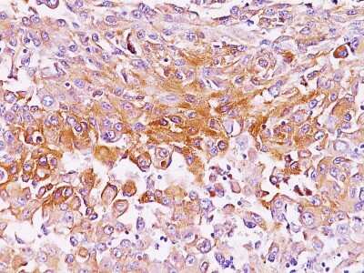 Immunohistochemistry-Paraffin: PMEL17/SILV Antibody (SPM286) [NBP2-32855]