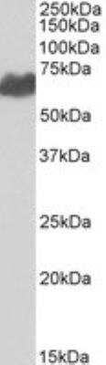 Western Blot: PMEL17/SILV Antibody [NB100-41098]