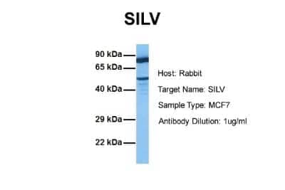 Western Blot: PMEL17/SILV Antibody [NBP1-69571]