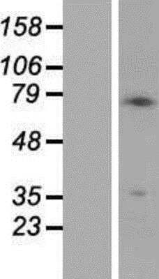 Western Blot: PMEL17/SILV Overexpression Lysate [NBL1-15968]