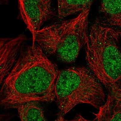 Immunocytochemistry/ Immunofluorescence: PMF1 Antibody [NBP2-56734]