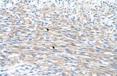 Immunohistochemistry: PMF1 Antibody [NBP2-85504]