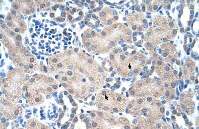 Immunohistochemistry: PMF1 Antibody [NBP2-85504]