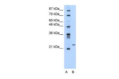 Western Blot: PMF1 Antibody [NBP2-85503]