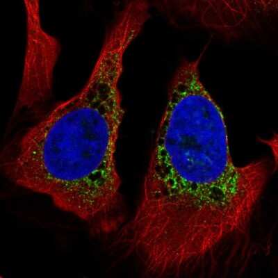 Immunocytochemistry/ Immunofluorescence: PMFBP1 Antibody [NBP2-55610]