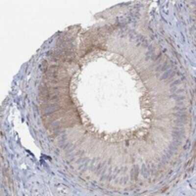 Immunohistochemistry-Paraffin: PMFBP1 Antibody [NBP3-17913]