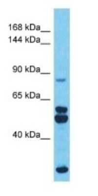 Western Blot: PMFBP1 Antibody [NBP3-09242]