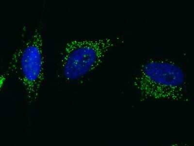 Immunocytochemistry/ Immunofluorescence: PML Protein Antibody [NBP2-98822]