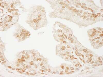 Immunohistochemistry-Paraffin: PML Protein Antibody [NB100-59788]