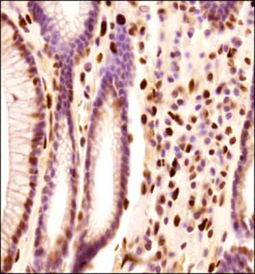 Immunohistochemistry-Paraffin: PML Protein Antibody - BSA Free [NB100-59787]