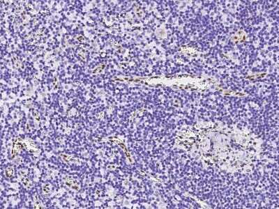 Immunohistochemistry-Paraffin: PML Protein Antibody [NBP2-98822]
