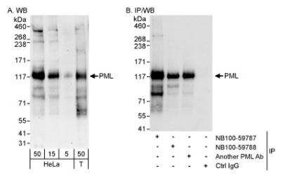 Western Blot: PML Protein AntibodyBSA Free [NB100-59787]