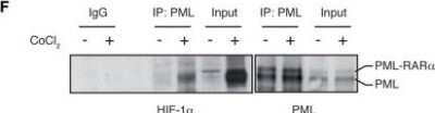Western Blot: PML Protein AntibodyBSA Free [NB100-59787]