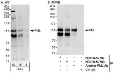 Western Blot: PML Protein Antibody [NB100-59788]