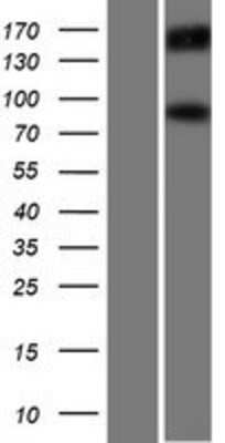 Western Blot: PML Protein Overexpression Lysate [NBP2-05900]