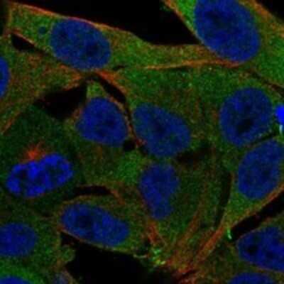 Immunocytochemistry/ Immunofluorescence: PMM1/Phosphomannomutase 1 Antibody [NBP3-17530]