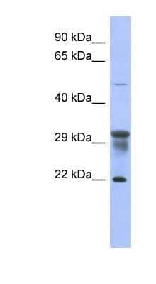 Western Blot: PMM1/Phosphomannomutase 1 Antibody [NBP1-55475]