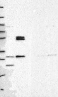 Western Blot: PMM1/Phosphomannomutase 1 Antibody [NBP3-17530]