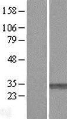 Western Blot: PMM1/Phosphomannomutase 1 Overexpression Lysate [NBL1-14536]