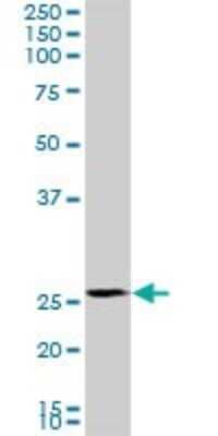 Western Blot: PMM2/Phosphomannomutase 2 Antibody (2A5) [H00005373-M02]