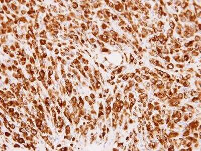 Immunohistochemistry-Paraffin: PMM2/Phosphomannomutase 2 Antibody [NBP1-33750]