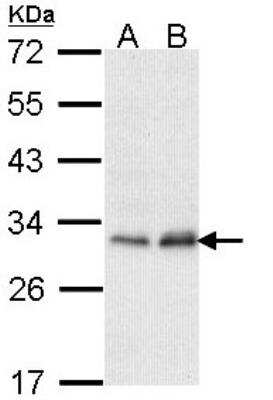 Western Blot: PMM2/Phosphomannomutase 2 Antibody [NBP1-33750]