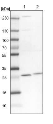 Western Blot: PMM2/Phosphomannomutase 2 Antibody [NBP1-85716]