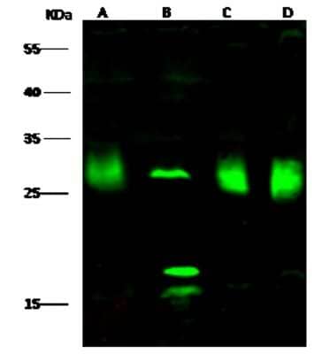 Western Blot: PMM2/Phosphomannomutase 2 Antibody [NBP3-00351]