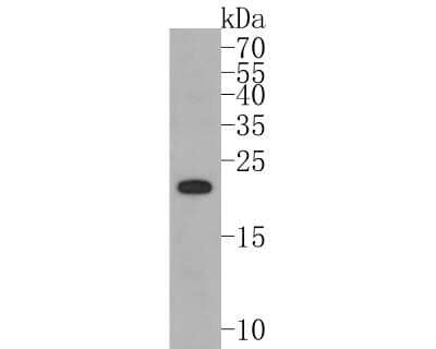 Western Blot: PMP22 Antibody (JM52-30) [NBP2-67068]