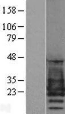 Western Blot: PMP22 Overexpression Lysate [NBP2-04429]