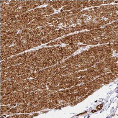 Immunohistochemistry-Paraffin: SLC25A17 Antibody [NBP2-30684]