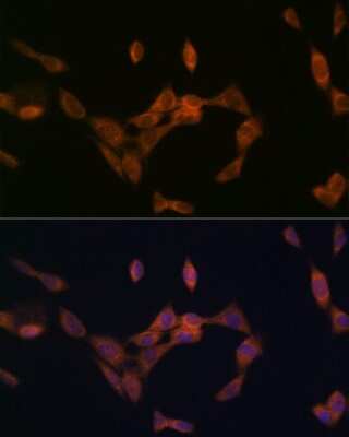 Immunocytochemistry/ Immunofluorescence: PMP70 Antibody (3V4K3) [NBP3-16348]
