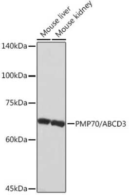 Western Blot: PMP70 Antibody (3V4K3) [NBP3-16348]