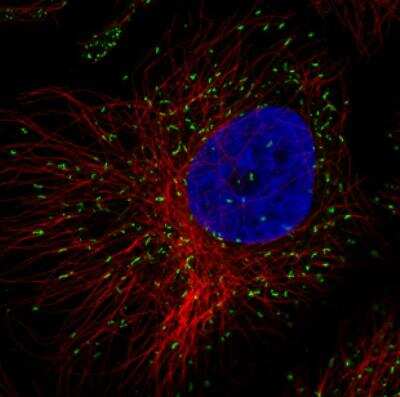 Immunocytochemistry/ Immunofluorescence: PMP70 Antibody (CL2524) [NBP2-36770]