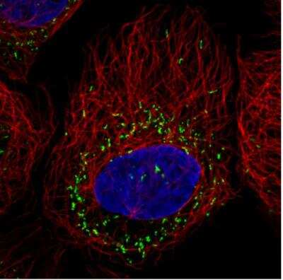 Immunocytochemistry/ Immunofluorescence: PMP70 Antibody (CL2524) [NBP2-36770]