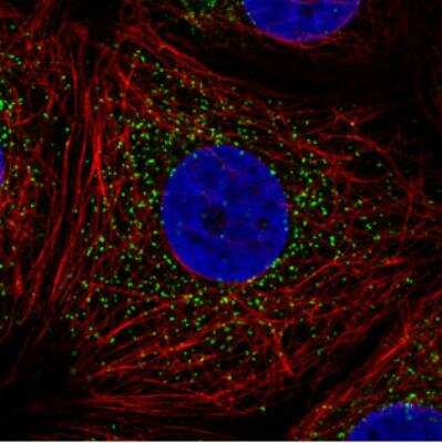 Immunocytochemistry/ Immunofluorescence: PMP70 Antibody (CL2524) [NBP2-36770]