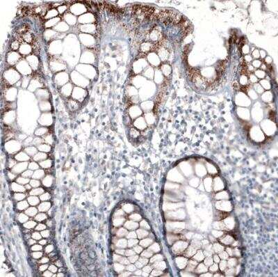 Immunohistochemistry-Paraffin: PMP70 Antibody (CL2524) [NBP2-36770]