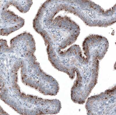 Immunohistochemistry-Paraffin: PMP70 Antibody (CL2524) [NBP2-36770]