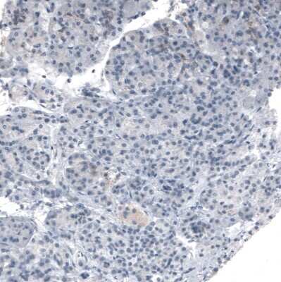 Immunohistochemistry-Paraffin: PMP70 Antibody (CL2524) [NBP2-36770]