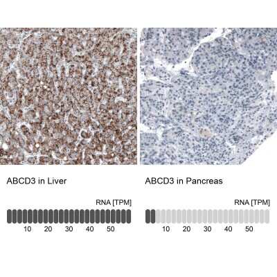 Immunohistochemistry-Paraffin: PMP70 Antibody (CL2524) [NBP2-36770]