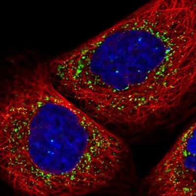 Immunocytochemistry/ Immunofluorescence: PMP70 Antibody [NBP2-38199]