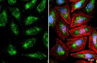 Immunocytochemistry/ Immunofluorescence: PMP70 Antibody [NBP3-13153]