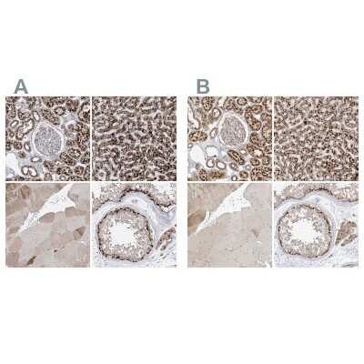 Immunohistochemistry-Paraffin: PMP70 Antibody [NBP1-87258]