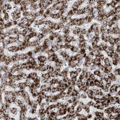 Immunohistochemistry-Paraffin: PMP70 Antibody [NBP1-87258]