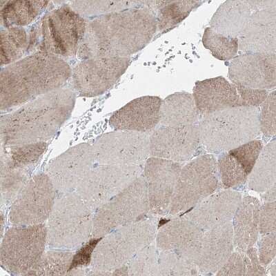 Immunohistochemistry-Paraffin: PMP70 Antibody [NBP1-87258]